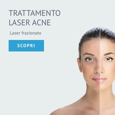 Chirurgo plastico trattamento laser acne
